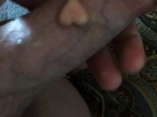 Minha pérola (implante) em meu pau: d